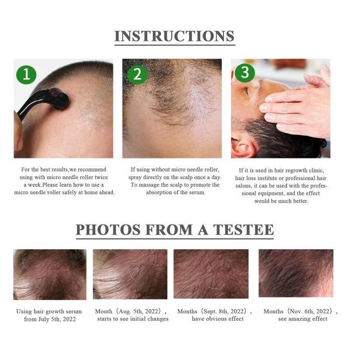 Best Effective Hair Growth Serum Spray Anti Stripping Nourishing Hair Care For Men Women 1
