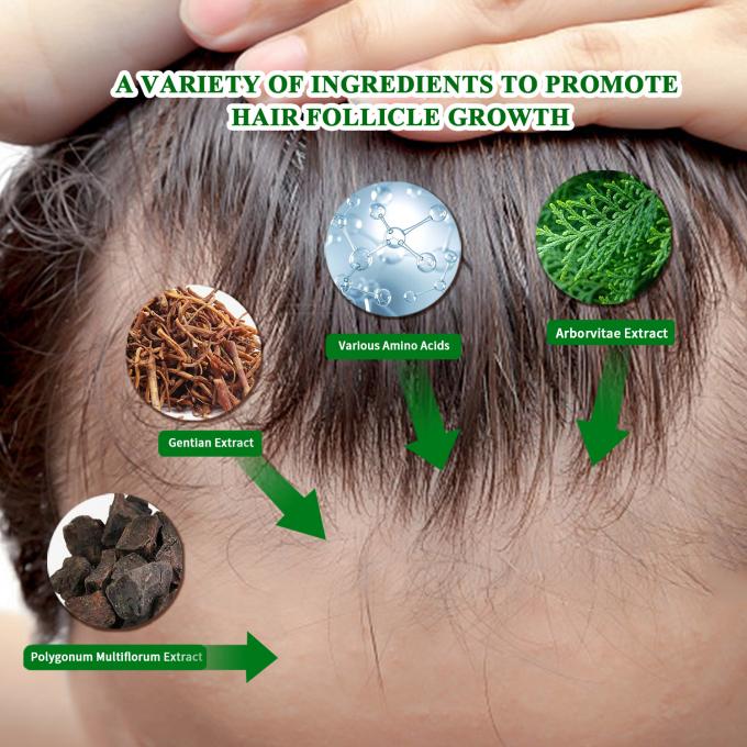 Organic Hair Growth Serum External Use Hair Regrowth Treatment Anti Hair Loss Spray 80ml 0